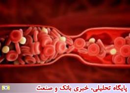لختگی خون عامل بروز سندرم کووید طولانی مدت